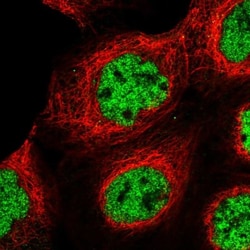 SR140 Antibody, Novus Biologicals 0.1mL; Unlabeled:Antibodies, Polyclonal
